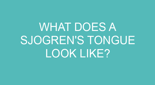 What Does A Sjogren's Tongue Look Like?
